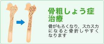 骨粗しょう症治療